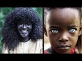 Top 15 Rarest Black People in The World That Are 1 In A Million