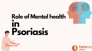 Role of Mental Health in Psoriasis