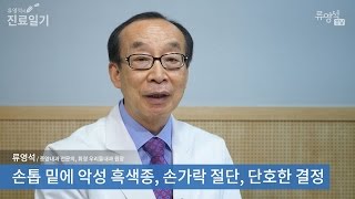 손톱 밑에 악성 흑색종, 손가락 절단, 단호한 결정 - 류영석 원장