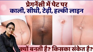 Nabhi Line se kaise pata kare Ladka hai ya Ladki | Baby Boy Prediction in Pregnancy | Gender Predict
