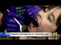 Benefits of braces at a younger age