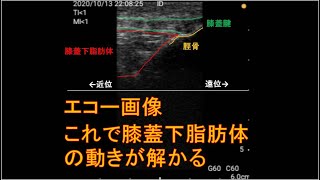 エコーで解かる膝蓋下脂肪体の動き　まとめ編