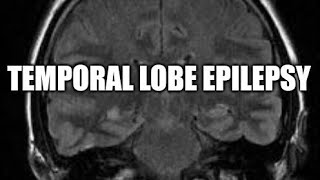 Temporal lobe epilepsy