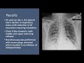 microsurgical resection of a medullary cavernous malformation through a far lateral approach