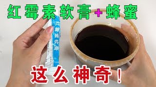 【生活小妙招】紅黴素軟膏和蜂蜜拌一起，原來有這麼多好處，解決家家戶戶的困擾！【生活小幫手安姐】