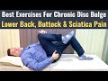 Chronic Sciatica Pain Treatment, Chronic Lower Back Pain Exercise, Chronic Herniated Disc Treatment