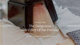 The Dangerous Side Effect Of Fat Freezing
