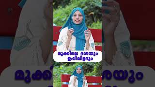 മൂക്കിലെ ദശയും, ഉപ്പിലിട്ടതും !! mookile dasha malayalam #polyps #allergies #coryza #children