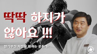 강직도 유지가 안되는 이유?