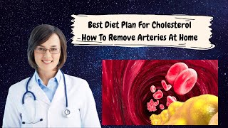 Best Diet Plan For Cholesterol - How To Remove Arteries At Home