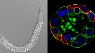 Mutant worms and mini organs: researching human development and disease