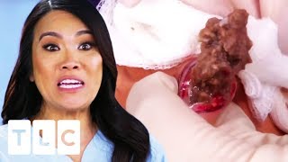 "It's Like Ground Beans!" | Dr. Pimple Popper
