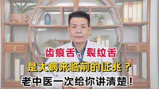 齿痕舌、裂纹舌，是大病来临前的征兆？老中医一次给你讲清楚！