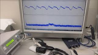 基礎実験ーー超音波プローブによる、スイープ発振システムーー（超音波システム研究所）