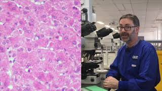 Microscope tutorial - Troubleshooting H&E stains