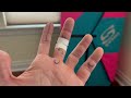 How to Tape A2 & A4 Pulley Injuries for Rock Climbing