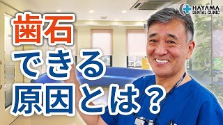 歯石ができる原因とは？できやすい人の特徴は？【千葉県柏市 JR「柏駅」徒歩14分 葉山歯科医院】