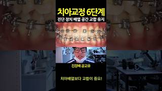 치아교정 과정 6단계 50초해설. 진장배공교유. 6요소 외우세요! 치아교정핵심6요소 중 교합이 가장 중요.전남대치대 교정전문의 아닌 교합고수 조명의 해설 2025_02_13