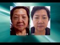 ido s clinic platelet rich plasma prp rejuvenation 富含血小板皮肤再生术 chinese