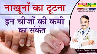 नाखूनों का टूटना इन चीजों की कमी का संकेत || WEAK NAILS HERE ARE SOME NUTRIENTS YOU LACK