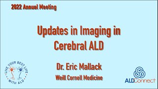 Updates in Imaging in Cerebral ALD – Dr. Eric Mallack