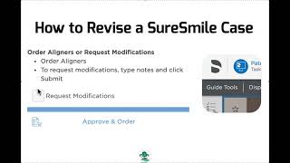 How to Revise a Sure Smile Case