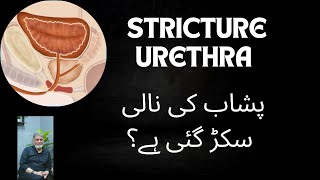 Stricture Urethra: | Urdu | | PROF DR JAVED IQBAL |