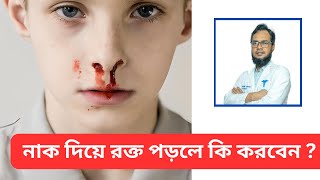 আঘাতের কারণে বা এমনিতেই নাক দিয়ে যদি রক্ত আসে, তাহলে ঘরোয়া সমাধান কি? কখন ডাক্তারের কাছে যাবেন?