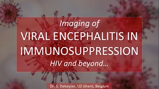 Imaging of viral Encephalitis (part 2): Viral Encephalitis in immunocompromised Patients (HIV...)