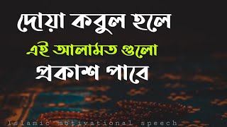 দোয়া কবুল হলে এই আলামত গুলো প্রকাশ পাবে। দুআ কবুলের আলামত।