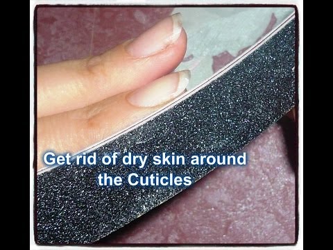 Get rid of Calloused Dry Skin around your Cuticles! Tip of The Day Get rid of Calloused Dry Skin around your Cuticles! Tip of The Day