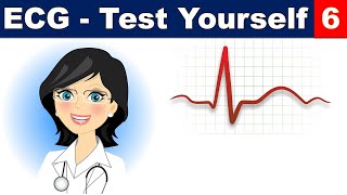 ECG (Test Yourself ) (6)      #usmle #internal_medicine #cme #ecg #محاضرات_باطنة #medicalstudent