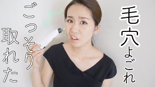 【閲覧注意】毛穴吸引器を使ったら汚れ取れまくり...