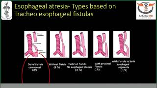 GE Webinar: Fetal GIT Obstructions by Dr Bimal J. Sahani