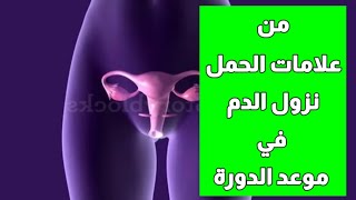 من علامات الحمل نزول دم في موعد الدوره|الفرق بين دم الحيض ودم الحمل|دم الحمل في موعد الدورة