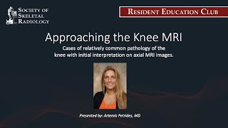 SSR Resident Education Club - Approaching the Knee MRI - Sep 15, 2021