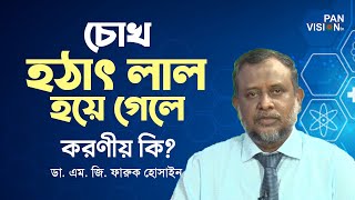 চোখ হঠাৎ লাল হয়ে গেলে করণীয় কি? ডা. এম. জি. ফারুক হোসাইন।স্বাস্থ্য বিষয়ক প্রশ্নোত্তর