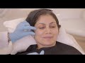 Restoring Youth with Dermal Fillers - Beauty Secrets with Dr. Jamuna Pai