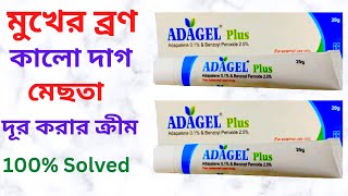 Adagel Plus Gel এর কাজ কি? এর উপকারিতা/ব্যবহার। এর Side Effects/Price। মুখের ব্রন দূর করার সেরা জেল।