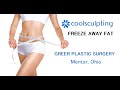 CoolSculpting Technology: A Better Solution for Fat Loss | Greer Plastic Surgery | Cleveland, OH