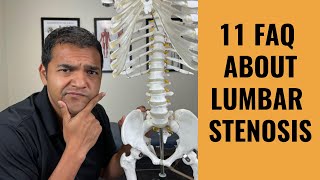 11 Most Frequently Asked Questions About Lumbar Spinal Stenosis