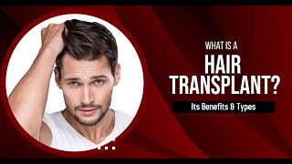 What is Hair Transplant and Types | Hair tranaplant in Vizag | Vjs Clinic | Hair Clinic in Vizag |