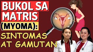 BU-KOL sa MA-TRIS (Myoma) : Sintomas at Gamutan - By  Doc Liza Ramoso-Ong