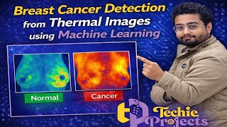 Breast Cancer Detection using Machine Learning | Breast Cancer Classification using CNN