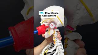 TMJ ROOT Cause Assessment
