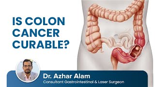 Is COLON CANCER Curable?  | Dr. Azhar Alam