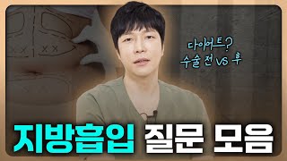 지방흡입 수술 전 가장 많이 하는 질문 모음 (통증 순위, 흡입량, 다이어트 시기 등)