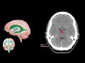 neuroanatomía seccional básica tac y rm el sistema