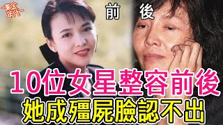 10位香港女星整容前後，有人成殭屍臉有人越來越美，萬萬沒想到她也動過鼻子#郭可盈#鄭裕玲#李彩樺#黃金年代