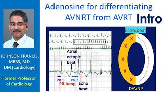 Adenosine for differentiating AVNRT from AVRT - Intro